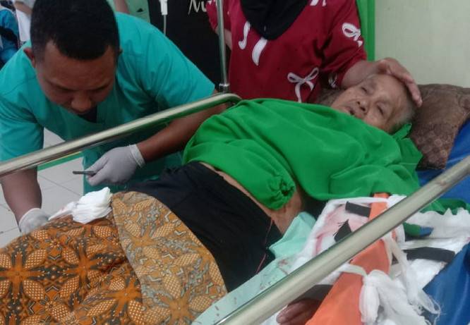 Diterkam Buaya Saat Cuci Pakaian di Sungai, Seorang Lansia di Inhil Alami Patah Tulang