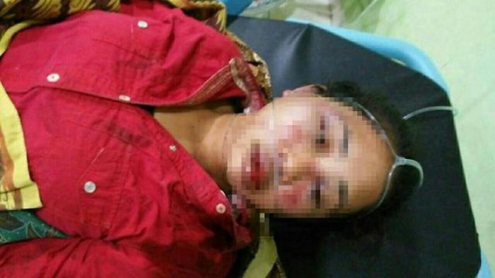Wanita di Bengkalis Bonyok Dihajar Pacar
